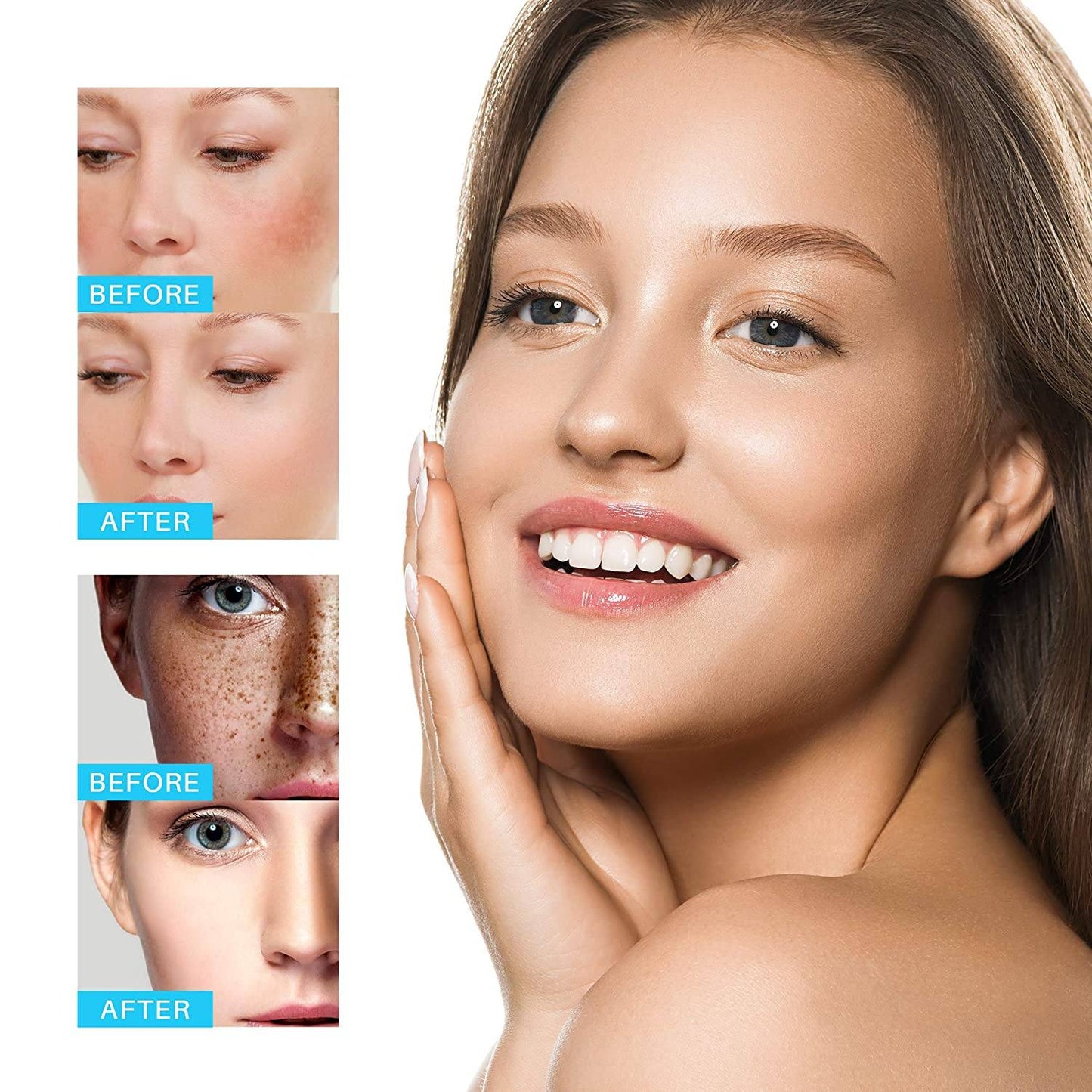 Clareador de Pele Intensivo Dark Spot - Remova as Manchas no seu Corpo Beleza e Cuidado Pessoal Wons Store 