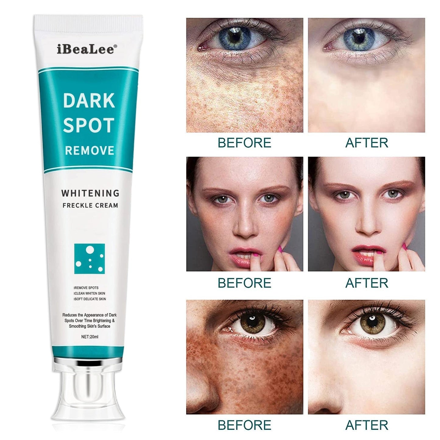 Clareador de Pele Intensivo Dark Spot - Remova as Manchas no seu Corpo Beleza e Cuidado Pessoal Wons Store 