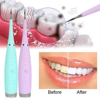 DenteClean Ultrassônico Pro - Seus Dentes Claros e sem Tártaro Wons Store 